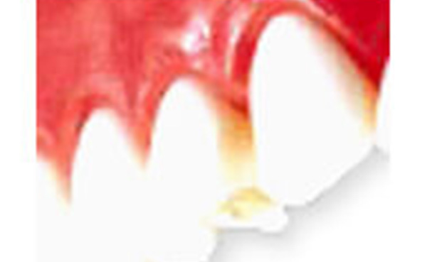 cosmetic-dentistry img 04