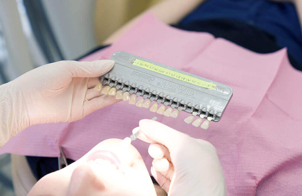 teeth_whitening img 06